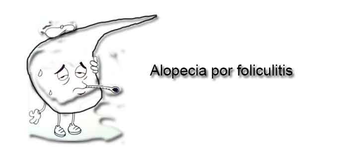 Alopecia por foliculitis