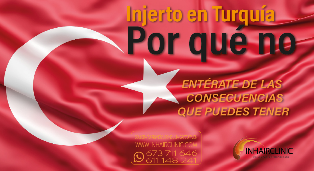 riesgos de Injerto capilar en Turquía inhairclinic madrid